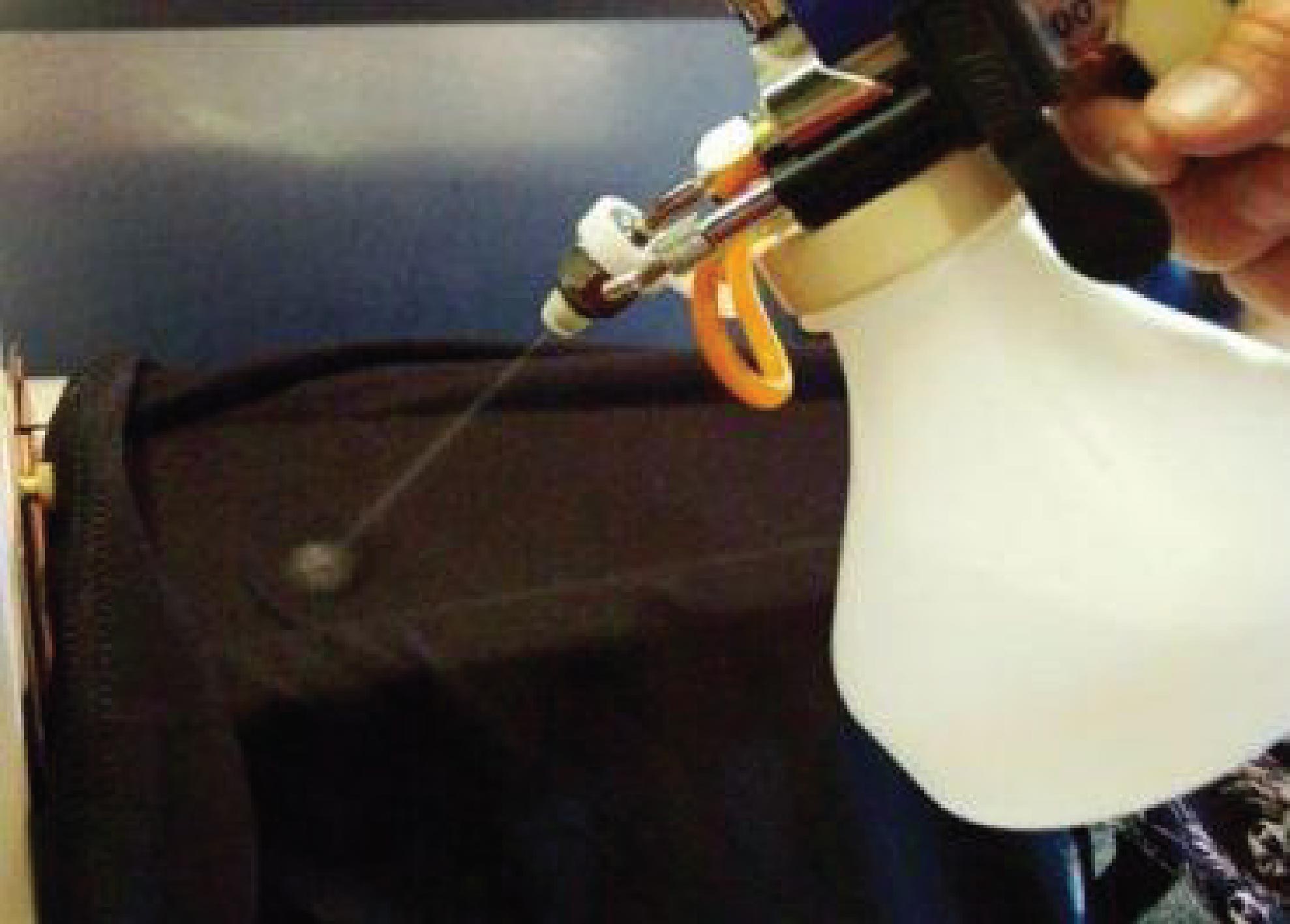 LEKE ÇIKARICI SOLVENT